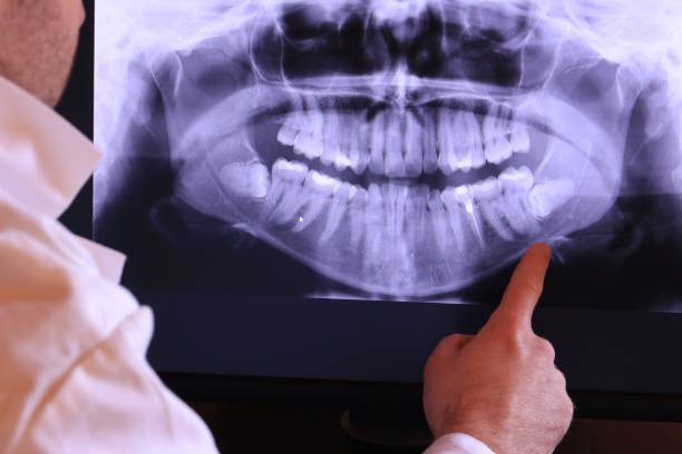 Best Emergency Tooth Extraction in Glen Rock, NJ