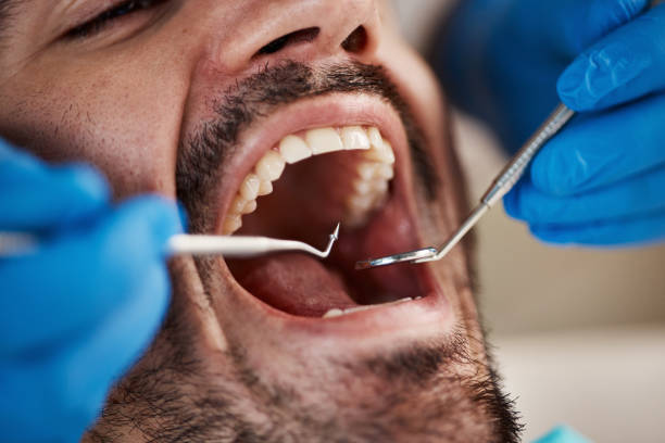 Best Emergency Treatment for Toothache in Glen Rock, NJ