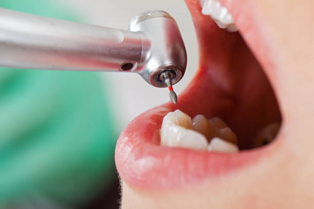 Best Pediatric Emergency Dentist in Glen Rock, NJ